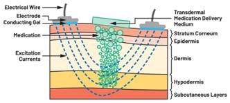  圖5.人體皮膚分層橫截面以及TMD和生物阻抗測量  考慮到生物阻抗分析的無創(chuàng)性，使用兩個金屬電極代表電氣傳感器，連接模擬前端(AFE)電路和患者皮膚。這個金屬與非金屬的接觸點(diǎn)是構(gòu)成整個電路的另一個關(guān)鍵部分，連接了AFE和人體電氣模型。電荷載體（電極中的電子和人體內(nèi)的離子）之間的相互作用可能對這些傳感器的性能產(chǎn)生重大影響，需要根據(jù)每種應(yīng)用進(jìn)行具體考慮。首先，金屬與離子溶液接觸的相互作用導(dǎo)致金屬表面附近溶液中離子濃度的局部變化。這種現(xiàn)象會改變電極下方區(qū)域的電荷中性，導(dǎo)致金屬周圍的電解質(zhì)電位與溶液其余部分不同，從而在金屬和電解質(zhì)主體之間產(chǎn)生一個電位差，即常說的“半電池電位”。其次，注入電流的直流分量會導(dǎo)致電極極化。  表1.各種電極類型和相應(yīng)的半電池電位  金屬及反應(yīng)  半電池電位(V)  Al → Al3+ + 3e- Al → Al3+ + 3e-  –1.706 –1.706  Ni → Ni2+ + 2e- Ni → Ni2+ + 2e-  –0.230 -0.230  H2 → 2H+ + 2e- H2 → 2H+ + 2e-  0.000 (by definition) 0.000（根據(jù)定義）  Ag + Cl- → AgCl + e- Ag + Cl- → AgCl + e-  +0.223 +0.223  Ag → Ag+ + e- Ag → Ag+ + e-  +0.799 +0.799  Au → Au+ + e- Au → Au+ + e-  +1.680 +1.680  這是一種不良現(xiàn)象，往往導(dǎo)致電極性能下降。這些考量表明，電極也需要定義適當(dāng)?shù)碾姎饽Ｐ停▍⒁妶D6）。我們可以將干電極表示為具有三個串聯(lián)元件的電路：一個用于模擬半電池電位(EHC)的直流電源；一個用于模擬金屬和非金屬（人體）之間接觸的RC并聯(lián)電池(Rd||Cd)；以及一個用于模擬電極金屬的電阻Rs。